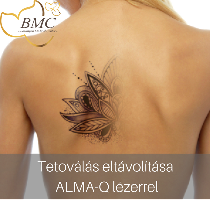 Meggondolatlan döntést hoztál? 