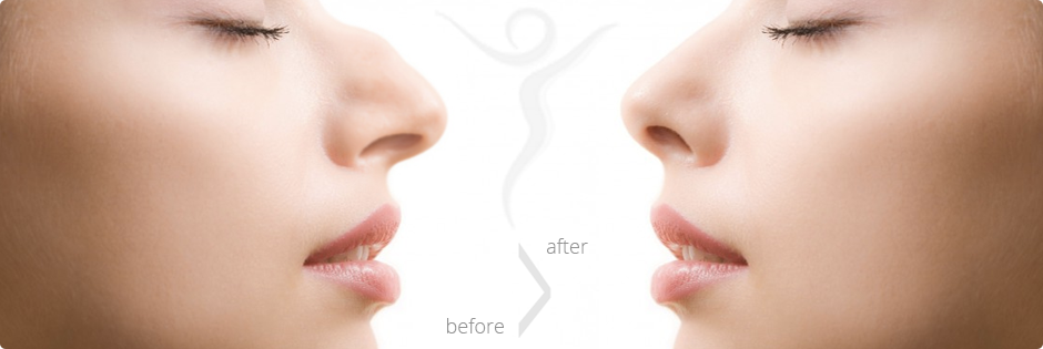 Orrplasztikai beavatkozás 