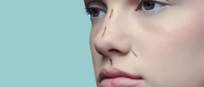 Orrplasztikai kezelések