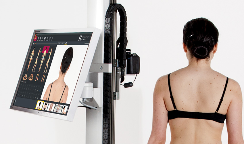 Anyajegyszűrés FotoFinder rendszerrel Borostyán Medical Center Bőrgyógyászat Magánklinika