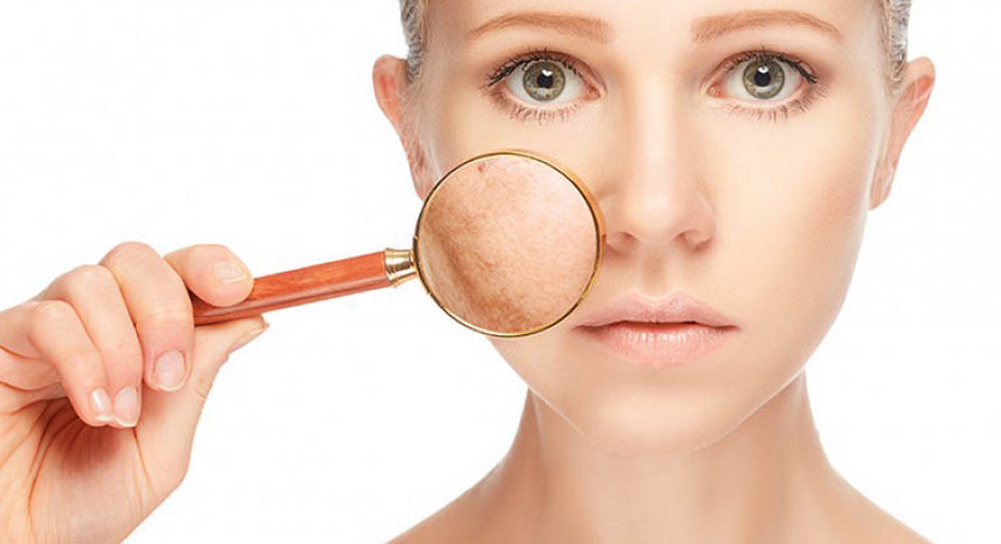 Pigmentfolt eltávolító lézeres kezelés