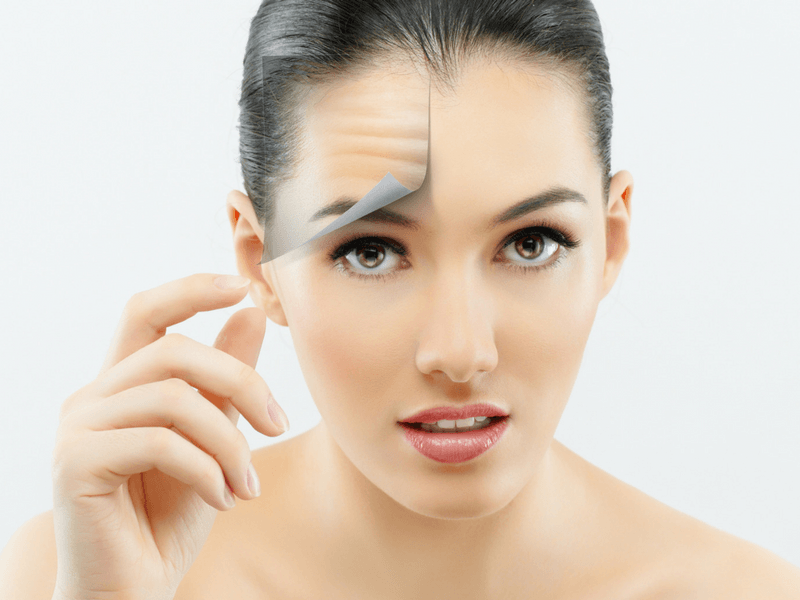 Rejuvenációs lézeres kezelés eredménye